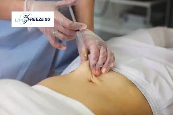 How Does Aqualyx Fat Dissolving Injection Work to Break Down Fat Witney?