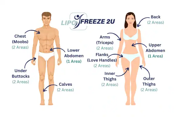 Areas you can have fat freezing treatment Witney