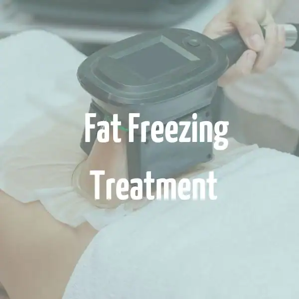 fat freezing treatment Witney