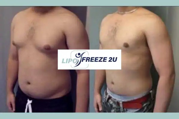 How Long Does It Take to See Results Witney?