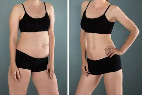 Are There Any Side Effects or Risks to Consider Witney?